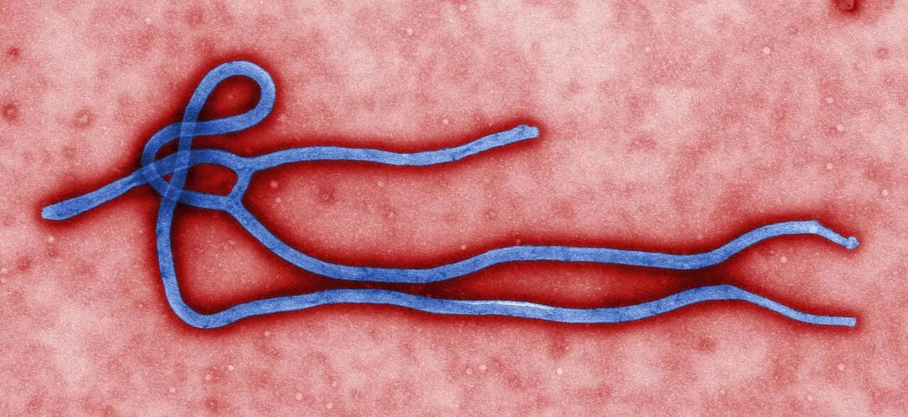 Ebola virion